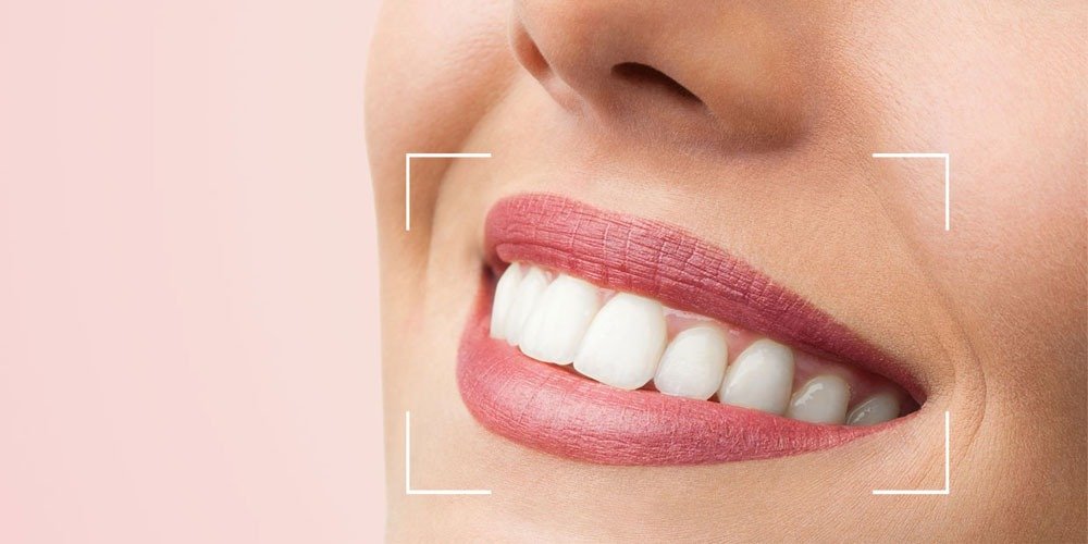 Smile Designing treatment in Faridabad