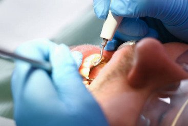 Best Dental Surgeon in Faridabad