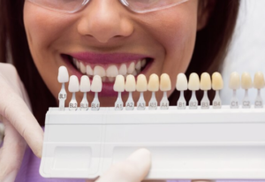 Best Tooth Colored Filling Services in Faridabad