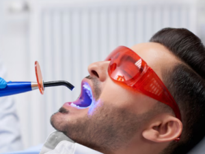 Best Teeth Whitening Centre in Faridabad