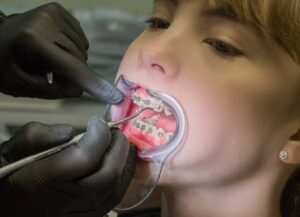 Best Modern Dental Braces Services in Faridabad