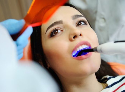 Best Tooth Coloured Filling Treatment in Faridabad