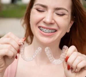 Best Aligners and Braces Treatment in Sector 21, Faridabad